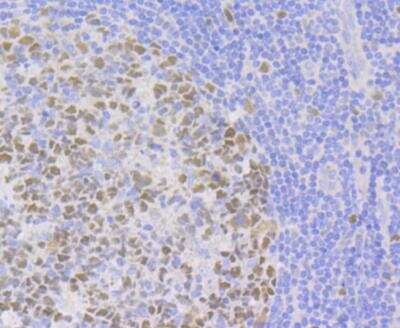 Immunohistochemistry: CHAF1A Antibody (JG38-98) [NBP2-76859] - Immunohistochemical analysis of paraffin-embedded human tonsil tissue using anti-p150 CAF1 antibody. Counter stained with hematoxylin.