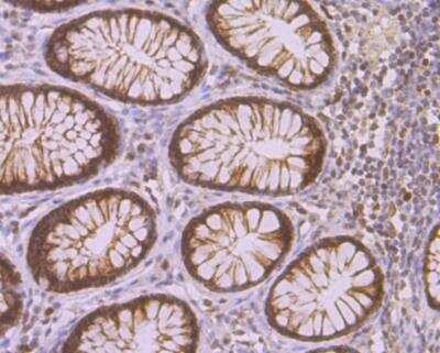 Immunohistochemistry: CHAF1A Antibody (JG38-98) [NBP2-76859] - Immunohistochemical analysis of paraffin-embedded human colon tissue using anti-p150 CAF1 antibody. Counter stained with hematoxylin.
