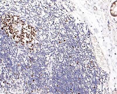 Immunohistochemistry-Paraffin: CHAF1A Antibody (JG38-98) [NBP2-76859] - Analysis of paraffin-embedded human colon tissue with Rabbit anti-CHAF1A antibody washed with ddH2O and PBS, and then probed with the primary antibody  at 1/200 dilution for 1 hour at room temperature. The detection was performed using an HRP conjugated compact polymer system. DAB was used as the chromogen. Tissues were counterstained with hematoxylin and mounted with DPX.