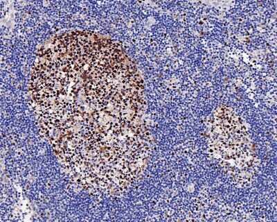 Immunohistochemistry-Paraffin: CHAF1A Antibody (JG38-98) [NBP2-76859] - Analysis of paraffin-embedded human lymph nodes tissue with Rabbit anti-p150 CHAF1A antibody washed with ddH2O and PBS, and then probed with the primary antibody  at 1/200 dilution for 1 hour at room temperature. The detection was performed using an HRP conjugated compact polymer system. DAB was used as the chromogen. Tissues were counterstained with hematoxylin and mounted with DPX.