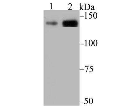 Western Blot: CHAF1A Antibody (JG38-98) [NBP2-76859] - Western blot analysis of p150 CAF1 on K562 (1) and A431 (2) cell lysate using anti-p150 CAF1 antibody at 1/1,000 dilution.