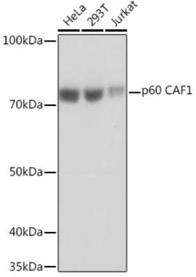 Western Blot: CHAF1B Antibody (7N0I2) [NBP3-16545] - Western blot analysis of extracts of various cell lines, using CHAF1B Rabbit mAb (NBP3-16545) at 1:1000 dilution. Secondary antibody: HRP Goat Anti-Rabbit IgG (H+L) at 1:10000 dilution. Lysates/proteins: 25ug per lane. Blocking buffer: 3% nonfat dry milk in TBST. Detection: ECL Basic Kit. Exposure time: 1s.