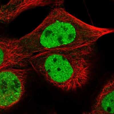 Immunocytochemistry/Immunofluorescence: CHAF1B Antibody [NBP1-88235] - Immunofluorescent staining of human cell line A-431 shows localization to nucleoplasm. Antibody staining is shown in green.