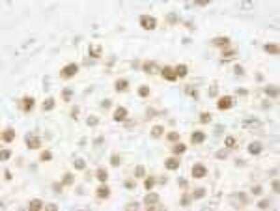 Immunohistochemistry-Paraffin: CHAF1B Antibody [NB100-57523] - FFPE section of human seminoma.  Affinity purified rabbit anti-CAF-1 p60 used at a dilution of 1:250.