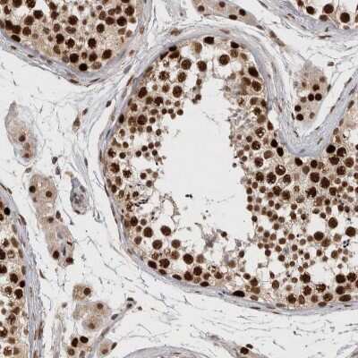 Immunohistochemistry-Paraffin: CHAF1B Antibody [NBP1-88235] - Staining of human testis shows strong nuclear positivity in cells in seminiferous ducts.