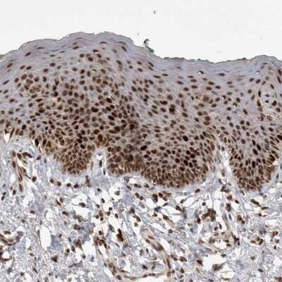 Immunohistochemistry-Paraffin: CHAF1B Antibody [NBP1-88235] - Staining of human skin shows strong nuclear positivity in squamous epithelial cells.