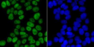 Immunocytochemistry/Immunofluorescence: CHAF1B Antibody (JG92-30) [NBP2-75439] - Staining p60 CAF1 in 293T cells (green). The nuclear counter stain is DAPI (blue). Cells were fixed in paraformaldehyde, permeabilised with 0.25% Triton X100/PBS.