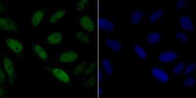 Immunocytochemistry/Immunofluorescence: CHAF1B Antibody (JG92-30) [NBP2-75439] - Staining p60 CAF1 in SiHa cells (green). The nuclear counter stain is DAPI (blue). Cells were fixed in paraformaldehyde, permeabilised with 0.25% Triton X100/PBS.