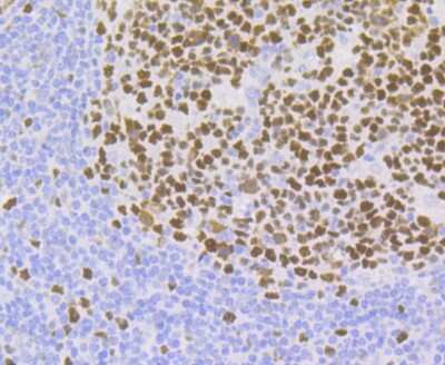 Immunohistochemistry-Paraffin: CHAF1B Antibody (JG92-30) [NBP2-75439] - Analysis of paraffin-embedded human tonsil tissue using anti-p60 CAF1 antibody. Counter stained with hematoxylin.