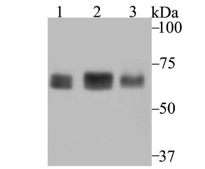 Western Blot: CHAF1B Antibody (JG92-30) [NBP2-75439] - Analysis of p60 CAF1 on different cell lysates using anti-p60 CAF1 antibody at 1/1,000 dilution.Positive control:Lane 1: SiHa       Lane 2: K562Lane 3: A431