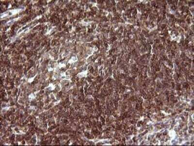 Immunohistochemistry: CHAF1B Antibody (OTI4F7) [NBP2-46274] - Analysis of Human lymph node tissue. (Heat-induced epitope retrieval by 10mM citric buffer, pH6.0, 120C for 3min)