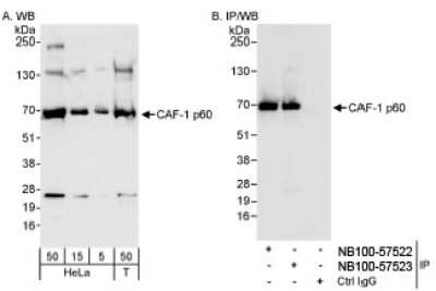 Western Blot: CHAF1B Antibody [NB100-57523] - Whole cell lysate from HeLa (5, 15 and 50 ug for WB; 1 mg for IP, 20% of IP loaded) and 293T (T; 50 ug) cells.  NB100-57523 used for WB at 0.04 ug/ml (A) and 1 ug/ml (B) and used for IP at 3 ug/mg lysate. CAF-1 p60 was also immunoprecipitated by rabbit anti-CAF-1 p60 antibody NB100-57522, which recognizes an upstream epitope. Test