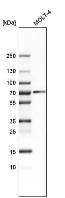 Western Blot: CHAF1B Antibody [NBP1-88235] - Analysis in human cell line MOLT-4.