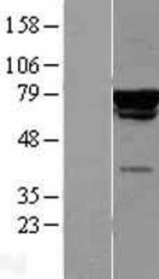 Western Blot: CHAF1B Overexpression Lysate (Adult Normal) [NBL1-09140] Left-Empty vector transfected control cell lysate (HEK293 cell lysate); Right -Over-expression Lysate for CHAF1B.