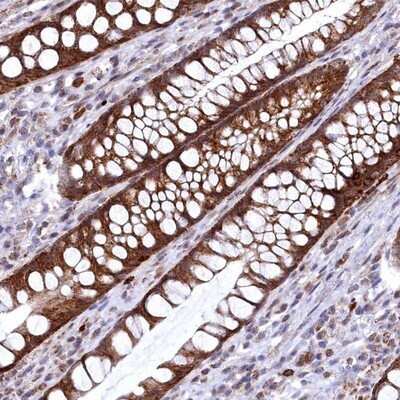 Immunohistochemistry-Paraffin CHCHD1 Antibody - BSA Free