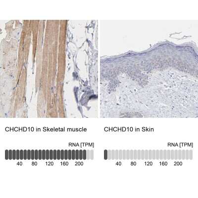 Immunohistochemistry-Paraffin CHCHD10 Antibody - BSA Free