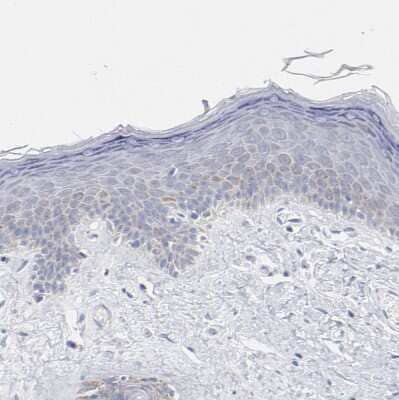 Immunohistochemistry-Paraffin CHCHD10 Antibody - BSA Free