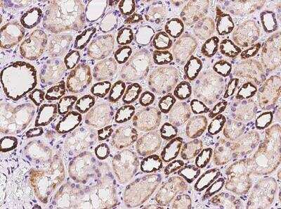 Immunohistochemistry-Paraffin: CHCHD10 Antibody [NBP3-05898] - Staining of human CHCHD10 in human kidney with rabbit polyclonal antibody at 1:100 dilution.