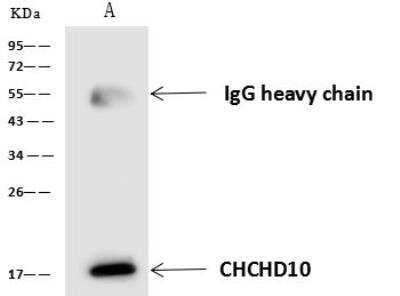 Immunoprecipitation: CHCHD10 Antibody [NBP3-05898] - Lane A:0.5 mg 293 Whole Cell Lysate4 uL anti-CHCHD10 rabbit polyclonal antibody and 60 ug of Immunomagnetic beads Protein A/G.Primary antibody:Anti-CHCHD10 rabbit polyclonal antibody,at 1:100 dilution Secondary antibody:Goat Anti-Rabbit IgG (H+L)/HRP at 1/10000 dilutionDeveloped using the ECL technique.Performed under reducing conditions.Predicted band size: 14 kDaObserved band size :17 kDa