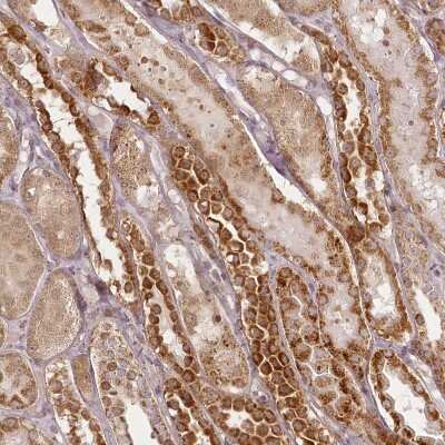 Immunohistochemistry-Paraffin CHCHD2 Antibody - BSA Free