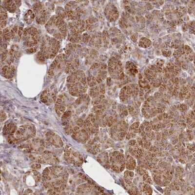 Immunohistochemistry-Paraffin CHCHD2 Antibody - BSA Free