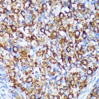 Immunohistochemistry-Paraffin: CHCHD2 Antibody [NBP2-92335] - Immunohistochemistry of paraffin-embedded Rat ovary using [KO Validated] CHCHD2 Rabbit pAb (NBP2-92335) at dilution of 1:100 (40x lens). Perform microwave antigen retrieval with 10 mM PBS buffer pH 7.2 before commencing with IHC staining protocol.