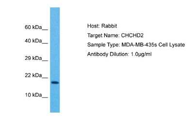 Western Blot: CHCHD2 Antibody [NBP2-84671] - Host: Rabbit. Target Name: CHCHD2. Sample Tissue: Human MDA-MB-435s Whole Cell lysates. Antibody Dilution: 1ug/ml