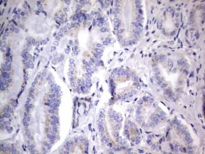 Immunohistochemistry: CHCHD3 Antibody (7G4) [NBP2-46281] - Analysis of Human prostate tissue.