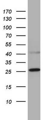 Western Blot: CHCHD3 Antibody (7G4) [NBP2-46281] - Analysis of A549 cell lysate (35ug).