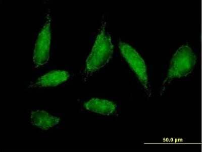 Immunocytochemistry/Immunofluorescence: CHCHD3 Antibody [H00054927-B01P] - Analysis of purified antibody to CHCHD3 on HeLa cell. (antibody concentration 10 ug/ml)