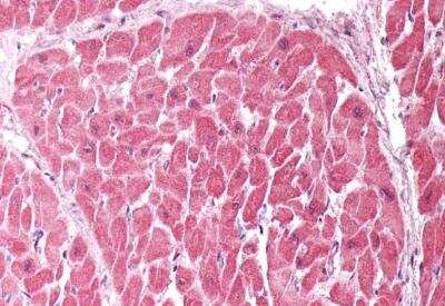 Immunohistochemistry-Paraffin: CHCHD3 Antibody [NBP1-52008] - Staining of paraffin embedded Human Heart. Antibody at 5 ug/mL. Steamed antigen retrieval with citrate buffer pH 6, AP-staining.