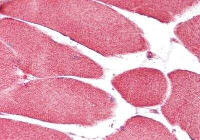 Immunohistochemistry-Paraffin: CHCHD3 Antibody [NBP1-52008] - Staining of paraffin embedded Human Skeletal Muscle. Antibody at 5 ug/mL. Steamed antigen retrieval with citrate buffer pH 6, AP-staining.