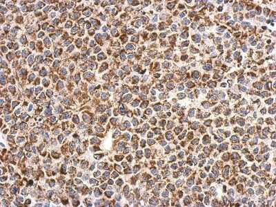 Immunohistochemistry-Paraffin: CHCHD3 Antibody [NBP2-21606] - Immunohistochemical analysis of paraffin-embedded Hela xenograft, using antibody at 1:500 dilution.