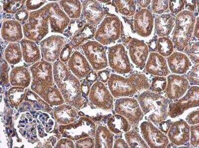 <b>Genetic Strategies Validation. </b>Immunohistochemistry-Paraffin: CHCHD3 Antibody [NBP2-21606] - CHCHD3 antibody detects CHCHD3 protein at cytoplasm in mouse kidney by immunohistochemical analysis. Sample: Paraffin-embedded mouse kidney. CHCHD3 antibody diluted at 1:500.