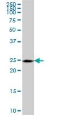 Western Blot: CHCHD3 Antibody [H00054927-B01P] - Analysis of CHCHD3 expression in human placenta.