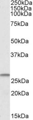 Western Blot: CHCHD3 Antibody [NBP1-52008] - Analysis of CHCHD3 in Human Heart lysate (35 ug protein in RIPA buffer) using NBP1-52008 at 1 ug/mL. Detected by chemiluminescence.