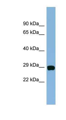 Western Blot: CHCHD3 Antibody [NBP1-56870] - Hela cell lysate, concentration 0.2-1 ug/ml.