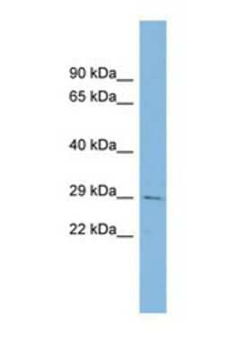 Western Blot: CHCHD3 Antibody [NBP1-56871] - This Anti-CHCHD3 antibody was used in Western Blot of Placenta  tissue lysate at a concentration of 1ug/ml.