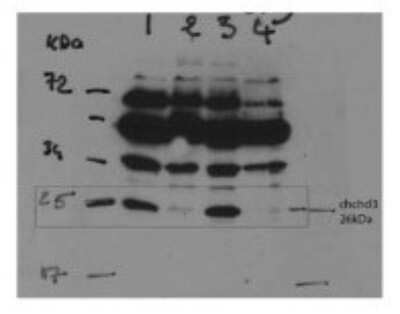 Western Blot: CHCHD3 Antibody [NBP1-56871] - Titration: 2 ug/ml Positive Control: whole cell protein extracts, immortalized human fibroblasts.