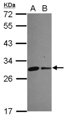 Western Blot: CHCHD3 Antibody [NBP2-21606] - Sample (30 ug of whole cell lysate) A: 293T B: A431 12% SDS PAGE gel, diluted at 1:5000.