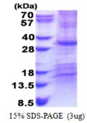 SDS-Page: CHCHD3 Protein [NBP2-22791]