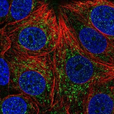 Immunocytochemistry/Immunofluorescence: CHCHD4 Antibody [NBP2-57060] - Staining of human cell line MCF7 shows localization to mitochondria.