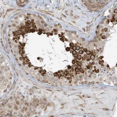 Immunohistochemistry-Paraffin: CHCHD4 Antibody [NBP1-83537] - Staining of human testis shows strong cytoplasmic positivity in cells in seminiferus ducts.
