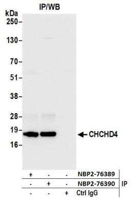 Immunoprecipitation: CHCHD4 Antibody [NBP2-76389] - Samples: Whole cell lysate (1.0 mg per IP reaction; 20% of IP loaded) from HeLa cells prepared using NETN lysis buffer. Antibodies: Affinity purified rabbit anti-CHCHD4 antibody NBP2-76389 used for IP at 15 ul per reaction. CHCHD4 was also immunoprecipitated by rabbit anti-CHCHD4 antibody NBP2-76390. For blotting immunoprecipitated CHCHD4, NBP2-76389 was used at 1:1000. Detection: Chemiluminescence with an exposure time of 3 seconds.