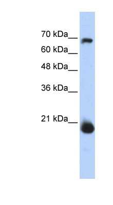 Western Blot: CHCHD4 Antibody [NBP1-54783] - Titration: 0.2-1 ug/ml, Positive Control: Transfected 293T.