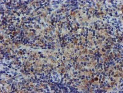 Immunohistochemistry: CHCHD5 Antibody (OTI3H3) - Azide and BSA Free [NBP2-72289] - Staining of paraffin-embedded Human lymphoma tissue using anti-CHCHD5 mouse monoclonal antibody.