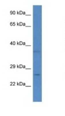 Western Blot: CHCHD6 Antibody [NBP1-79819] - Titration: 1.0 ug/ml Positive Control: Fetal Liver.