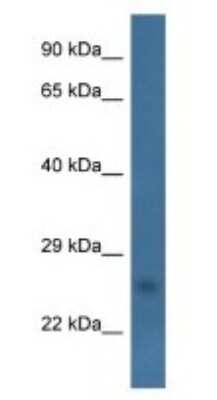 Western Blot: CHCHD6 Antibody [NBP1-79820] - Human Fetal Heart Lysate, concentration 1 ug/ml.