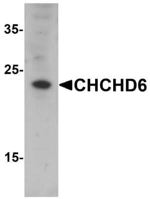 Western Blot: CHCHD6 Antibody [NBP2-81977] - Western blot analysis of CHCHD6 in SK-N-SH cell lysate with CHCHD6 antibody at 1 ug/mL.