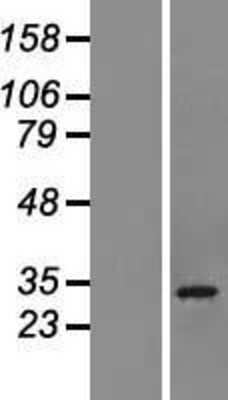 Western Blot: CHCHD6 Overexpression Lysate (Adult Normal) [NBL1-09144] Left-Empty vector transfected control cell lysate (HEK293 cell lysate); Right -Over-expression Lysate for CHCHD6.